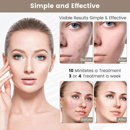 Advertisement for a skincare treatment showing before and after results with text about frequency of treatments.