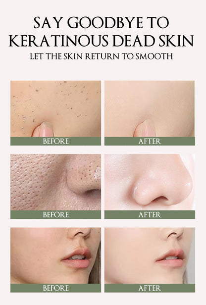 Herbaceous Exfoliating Peeling Gel Facial Scrub Moisturizing Nourishing Repair Scrubs Face Cream Beauty Skin Care