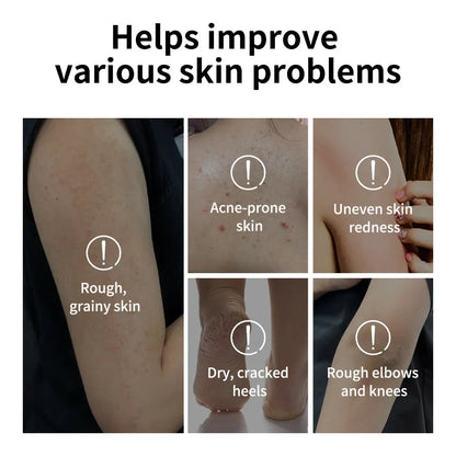 Glycolic Acid Exfoliating Body Stick Multiple Concerns Delivers Deep Effective Exfoliation Nourishing Moisture Deep Hydration