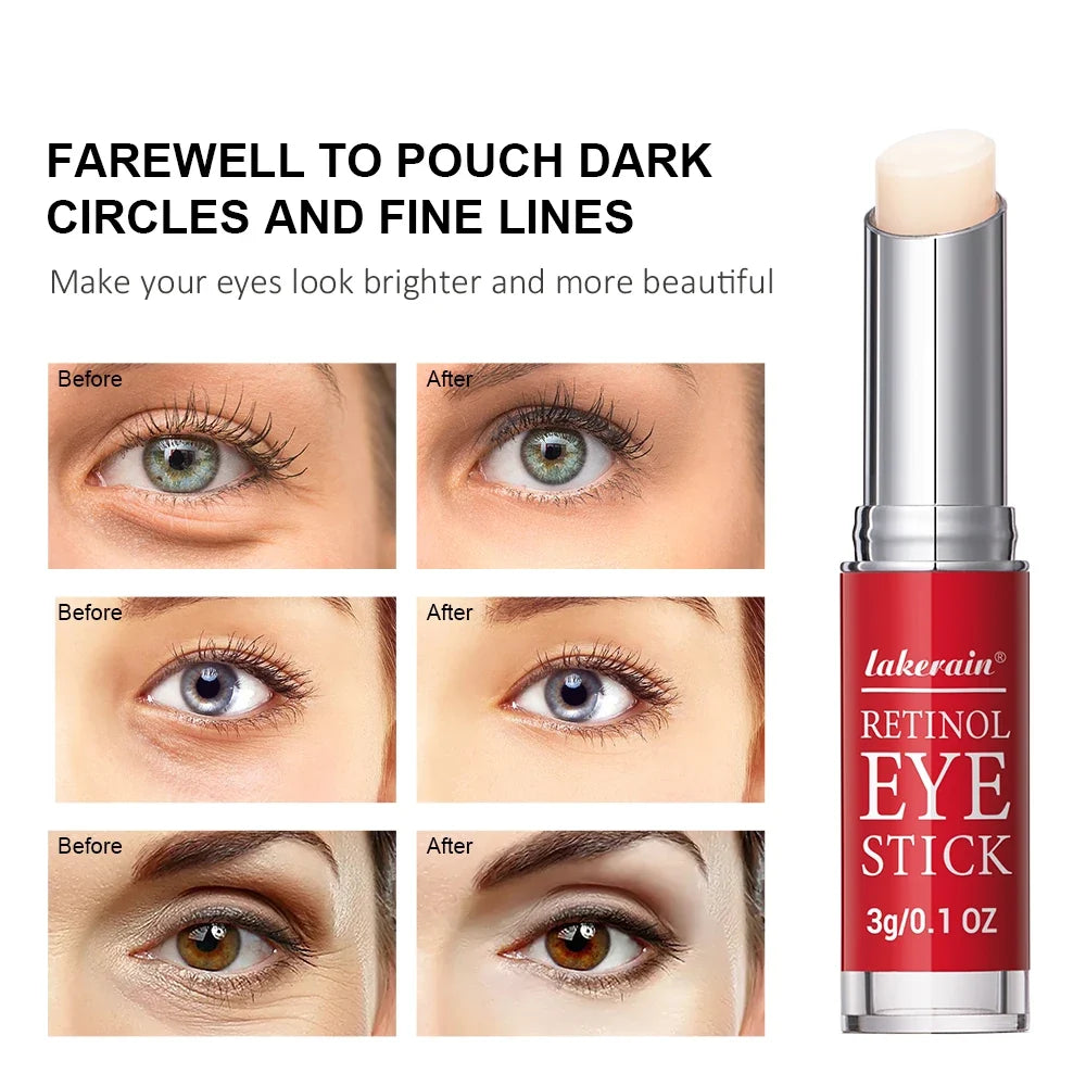 Retinol Eye Cream Lightening Dark Circles Firming Skin Instant Eye Repair Serum Stick for women Women Eyes Care
