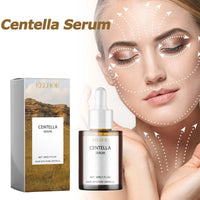 Centella Serum Nourish Improvement Dry Skin Smoothing Tightening Brightening Moisturizing Hyaluronic Acid Face Essence Skin Care