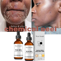 Acid Peeling Serum Chemical Exfoliant Peel For Remove Face Dark Skin Spots Whiten Lighten Melanin Peeling Solution Skin Peel
