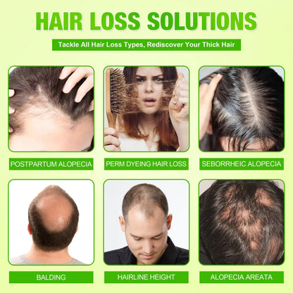 Anti-Hair Loss Scalp Care Roller Serum Kit Nourishes Roots Strengthens Hair Prevents Baldness Daily Care