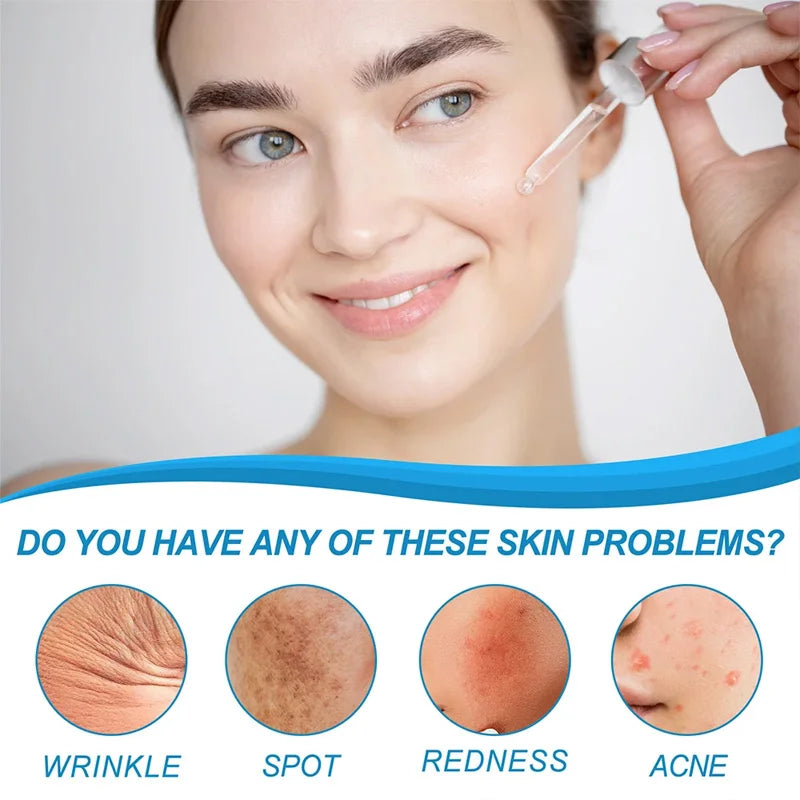 1/3/5pcs B5 Shrink Pores Serum Pure Hyaluronic Acid Lifting Firming Fine Lines Reduce Lightening Dark Circle 30ML Hyalu Essence