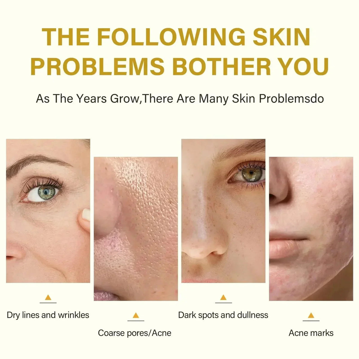 Acid Peeling Serum Chemical Exfoliant Peel For Remove Face Dark Skin Spots Whiten Lighten Melanin Peeling Solution Skin Peel