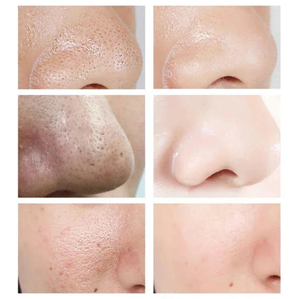 Remove Large Pores Serum Salicylic Acid Facial Pore Shrinking Tightening Pore Minimizing Firming Smooth Essence Korean Skin Care
