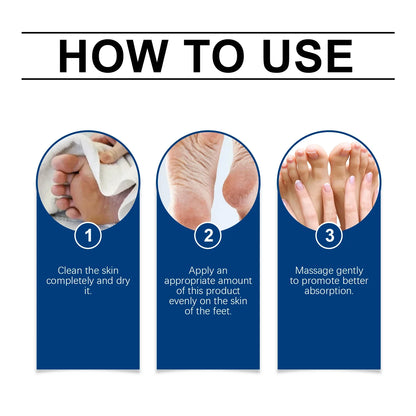 40% Urea Foot Cream Softening Dry Cracked Heels Deep Moisturizing Improve Roughness Remove Callus Exfoliation Foot Care Cream
