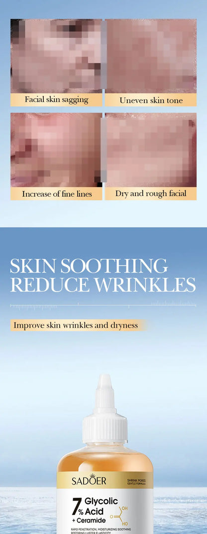 Toner SADOER Glycolic Acid Soothing Moisturizing Serum Improves Dirty and Dry Skin Fine Lines