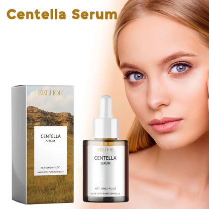 Centella Serum Nourish Improvement Dry Skin Smoothing Tightening Brightening Moisturizing Hyaluronic Acid Face Essence Skin Care