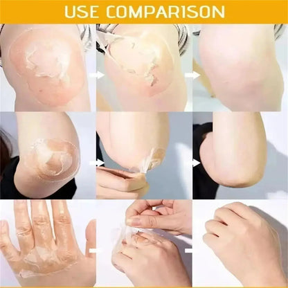 Acid Peeling Serum Chemical Exfoliant Peel For Remove Face Dark Skin Spots Whiten Lighten Melanin Peeling Solution Skin Peel